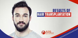 Results of hair transplantation