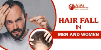 Hair fall in men and women