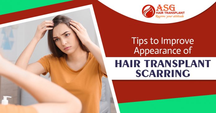 Tips to Improve Appearance of Hair transplant Scarring (3)