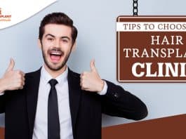 Tips to choose the hair transplant clinic