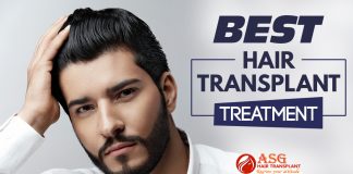 Best Hair transplant treatment