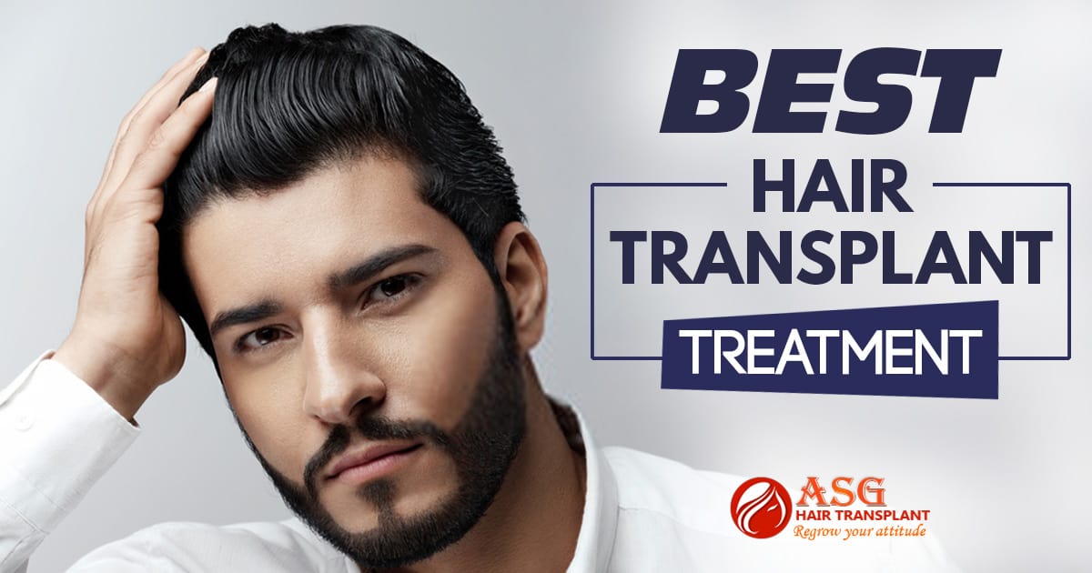 Which Method Of Hair Transplant Is Best If It Combines With PRP Injection?