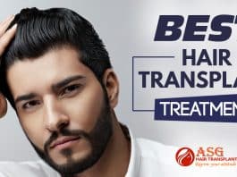 Best Hair transplant treatment Punjab