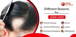 Different reasons for hair loss Punjab