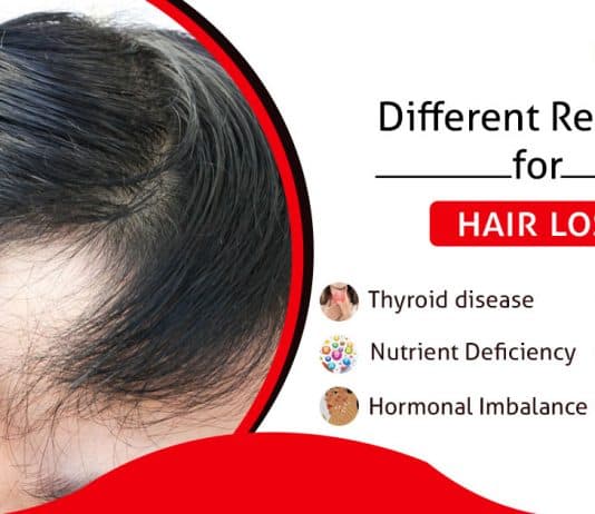Different reasons for hair loss Punjab