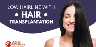 Low hairline with hair transplantation Punjab