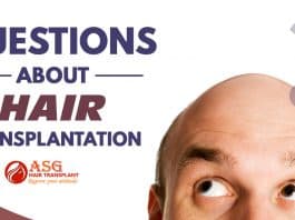 Questions about hair transplantation Punjab