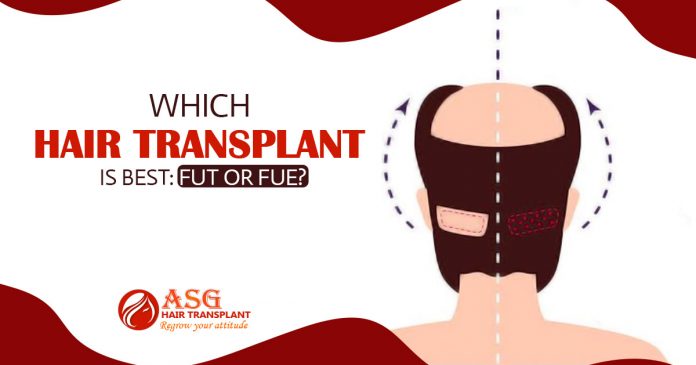 hair transplantation method is best FUT or FUE Hair Transplantation
