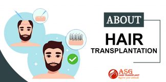 About hair transplantation Punjab