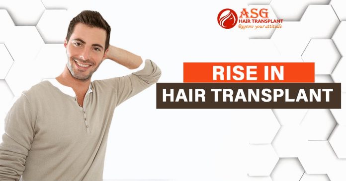 Rise in Hair Transplant