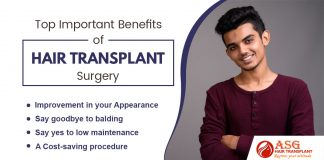 Top Important Benefits Of Hair Transplant Surgery Punjab
