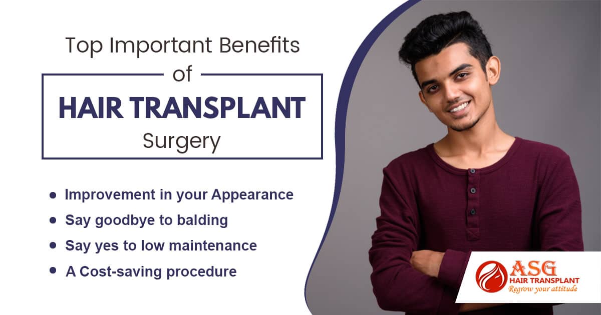 Top 5 Important Benefits Of Hair Transplant Surgery