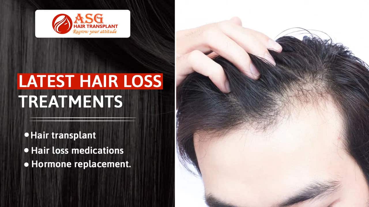 What are the latest hair loss treatments available in the market Punjab?