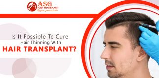 Is it possible to cure hair thinning with hair transplant