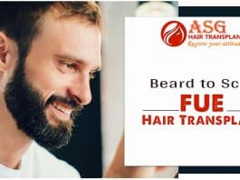 Beard to Scalp FUE Hair Transplant