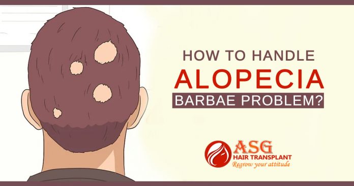 How to handle Alopecia Barbae Problem