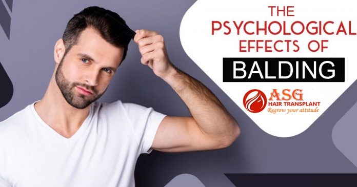 The Psychological Effects of Balding