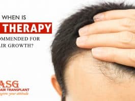 When is PRP therapy recommended for hair growth