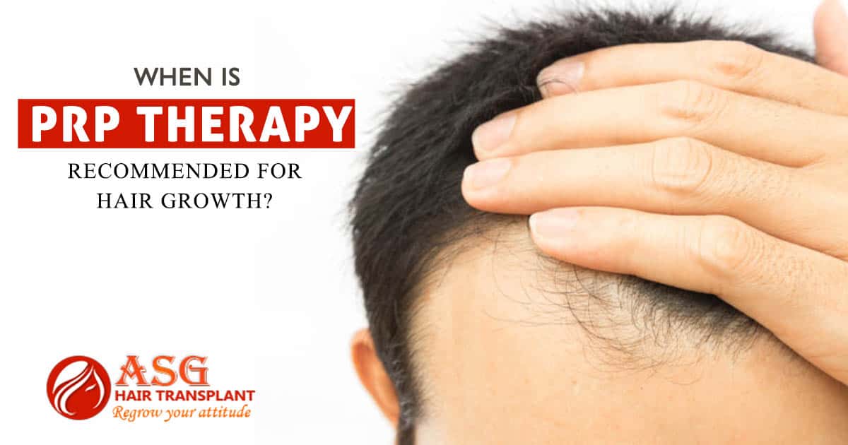 When To Consider Platelet-Rich Plasma Therapy For Hair Growth