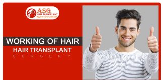 Working of hair transplant surgery