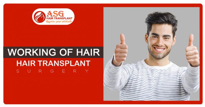 Working of hair transplant surgery