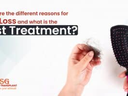 What are the different reasons for hair loss and what is the best treatment