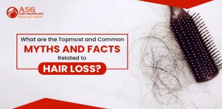What are the topmost and common Myths and facts related to hair loss