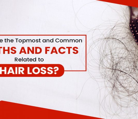 What are the topmost and common Myths and facts related to hair loss