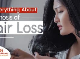 everything about the diagnosis of Hair Loss
