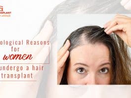 Psychological reason for hair loss