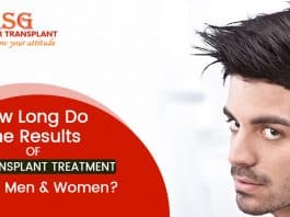 How long do the results of hair transplant treatment last for men & women