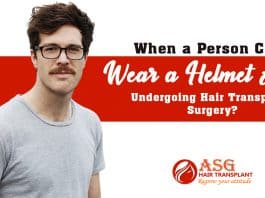 When a person can wear a helmet after undergoing hair transplant surgery