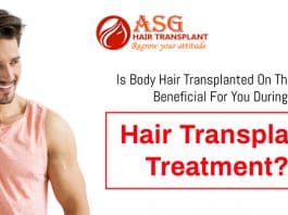 Is body hair transplanted on the head beneficial for you during hair transplant treatment