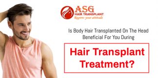 Is body hair transplanted on the head beneficial for you during hair transplant treatment