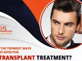 What are the topmost ways to get cost-effective hair transplant treatment