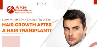 How-much-time-does-it-take-for-hair-growth-after-a-hair-transplant