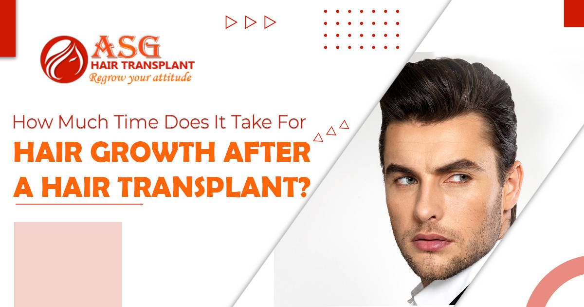 How much time does it take for hair growth after a hair transplant?