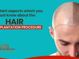 Important-aspects-which-you-must-know-about-the-hair-transplantation-procedure