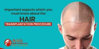 Important-aspects-which-you-must-know-about-the-hair-transplantation-procedure