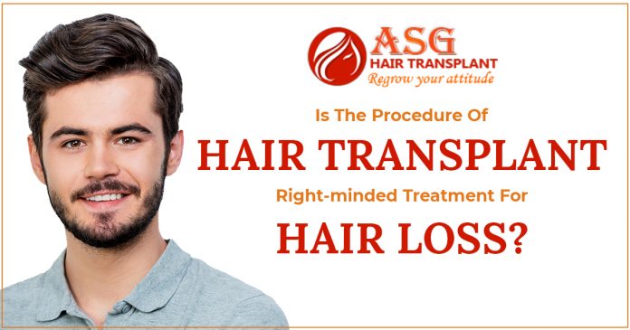 Is-the-procedure-of-hair-transplant-right-minded-treatment-for-hair-loss