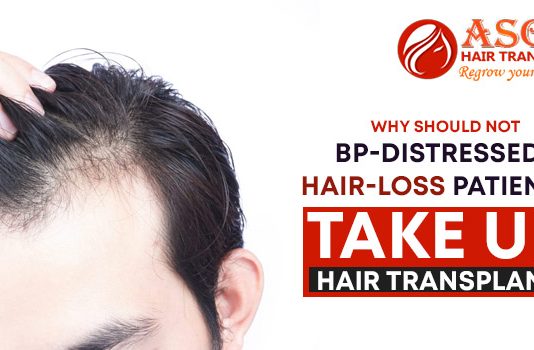 Why should not BP-distressed hair-loss patients take up hair transplant