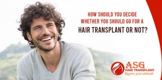 How should you decide whether you should go for a hair transplant or not