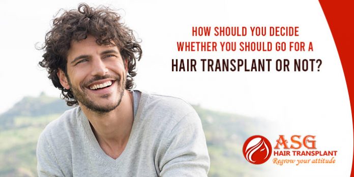 How should you decide whether you should go for a hair transplant or not