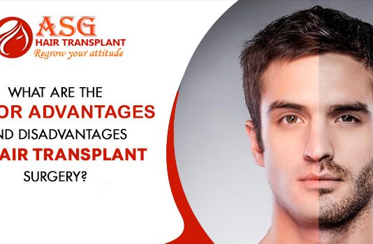 What are the major advantages and disadvantages of hair transplant surgery