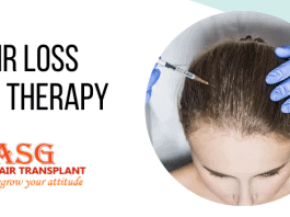 Hair Loss And PRP Therapy