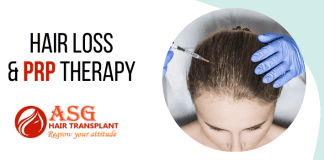 Hair Loss And PRP Therapy