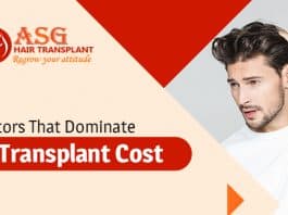 Factors that dominate hair transplant cost