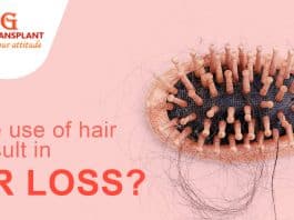 Can Use Of Hair Dye Result In Hair LosS
