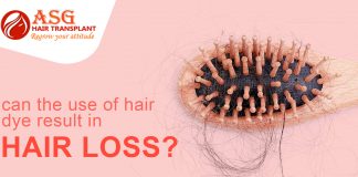 Can Use Of Hair Dye Result In Hair LosS