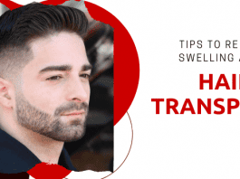Tips to reduce swelling after hair transplant